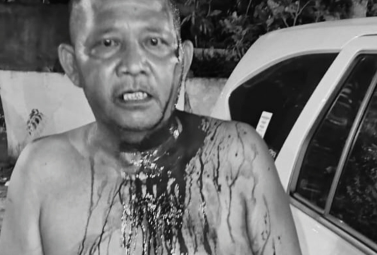 Sopir Rute Kendari-Bombana Ditikam Penumpang Misterius, Polisi Buru Pelaku 3